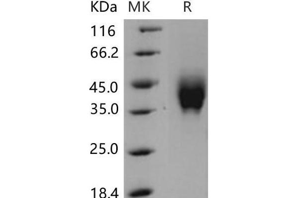 IFNGR2 Protein (His tag)