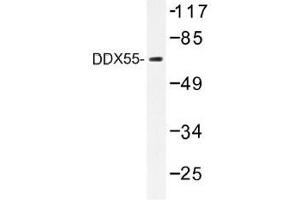 Image no. 1 for anti-DEAD (Asp-Glu-Ala-Asp) Box Polypeptide 55 (DDX55) antibody (ABIN317819) (DDX55 Antikörper)