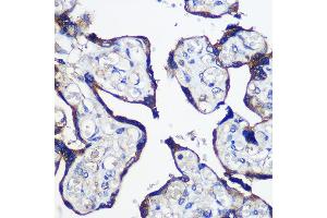 Immunohistochemistry of paraffin-embedded Human placenta using P Rabbit pAb (ABIN6133216, ABIN6145242, ABIN6145243 and ABIN6216694) at dilution of 1:100 (40x lens). (PARP8 Antikörper  (AA 1-300))