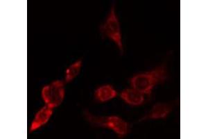 ABIN6274802 staining Hela cells by IF/ICC. (ACTR3 Antikörper  (C-Term))