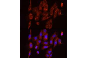 Immunofluorescence analysis of U2OS cells using S6 Ribosomal Protein (RPS6) Rabbit mAb (ABIN7270026) at dilution of 1:100 (40x lens). (RPS6 Antikörper)