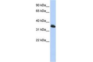 Image no. 1 for anti-LIM Homeobox 3 (LHX3) (C-Term) antibody (ABIN6742273)