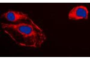 Immunofluorescent analysis of RKIP staining in HepG2 cells. (PEBP1 Antikörper  (Center))