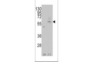Western Blotting (WB) image for anti-Solute Carrier Family 29 (Nucleoside Transporters), Member 4 (SLC29A4) (AA 452-481) antibody (ABIN387944)