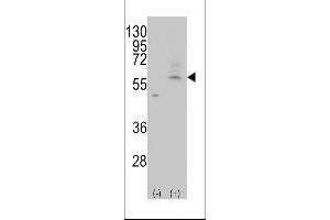 Western blot analysis of AT(Slc29a4) (arrow) using rabbit polyclonal AT(Slc29a4) Antibody (C-term) (ABIN387944 and ABIN2844505). (SLC29A4 Antikörper  (AA 452-481))