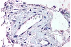 Human Testis, Vessels (formalin-fixed, paraffin-embedded) stained with ADAMTS1 antibody ABIN290128 at 13 ug/ml followed by biotinylated goat anti-rabbit IgG secondary antibody ABIN481713, alkaline phosphatase-streptavidin and chromogen. (ADAMTS1 Antikörper  (Internal Region))