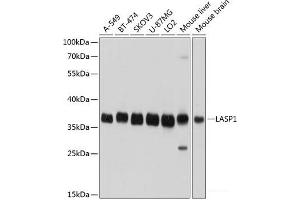 Western blot analysis of extracts of various cell lines using LASP1 Polyclonal Antibody at dilution of 1:1000. (LASP1 Antikörper)