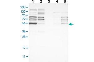 Western blot analysis of Lane 1: RT-4, Lane 2: U-251 MG, Lane 3: Human Plasma, Lane 4: Liver, Lane 5: Tonsil with WIPF2 polyclonal antibody  at 1:250-1:500 dilution.