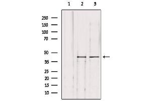 Western blot analysis of extracts from various samples, using KITH_HHV1S Antibody. (HHV-1 Thymidine Kinase Antikörper)