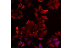 Immunofluorescence analysis of U2OS cells using PDLIM1 Polyclonal Antibody (PDLIM1 Antikörper)