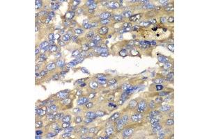 Immunohistochemistry (Paraffin-embedded Sections) (IHC (p)) image for anti-Solute Carrier Family 25 (Mitochondrial Carrier, Adenine Nucleotide Translocator), Member 4 (SLC25A4) (AA 40-298) antibody (ABIN3022646)