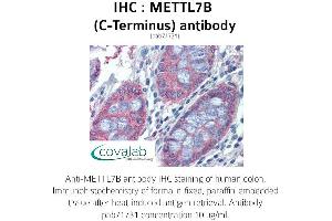 Image no. 1 for anti-Methyltransferase Like 7B (METTL7B) (C-Term) antibody (ABIN1736925) (METTL7B Antikörper  (C-Term))