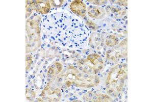 Immunohistochemistry of paraffin-embedded rat kidney using SULT1A1 antibody (ABIN5970776) at dilution of 1/100 (40x lens). (SULT1A1 Antikörper)