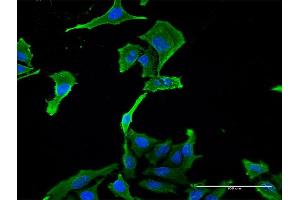 Immunofluorescence of monoclonal antibody to BNC1 on HeLa cell. (Basonuclin 1 Antikörper  (AA 599-705))