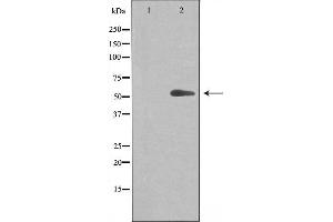 Western blot analysis of extracts from Jurkat cells, using Cytochrome P450 20A1 antibody. (CYP20A1 Antikörper  (Internal Region))
