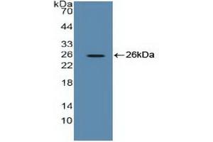 Figure. (EEF2 Antikörper  (AA 32-233))