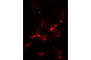 ABIN6275316 staining  NIH-3T3 cells by IF/ICC. (NUP160 Antikörper  (Internal Region))