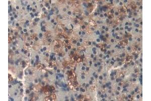 Immunohistochemistry (IHC) image for anti-Dihydrolipoamide Dehydrogenase (DLD) antibody (ABIN7442078)