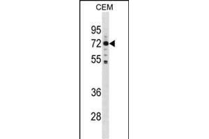 K Antibody (C-term) (ABIN1881520 and ABIN2838969) western blot analysis in CEM cell line lysates (35 μg/lane). (MAK Antikörper  (C-Term))