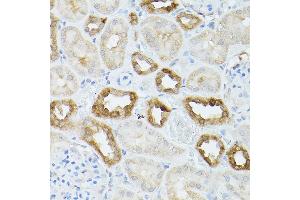 Immunohistochemistry (IHC) image for anti-Heat Shock 70kDa Protein 8 (HSPA8) (AA 1-300) antibody (ABIN3016124)