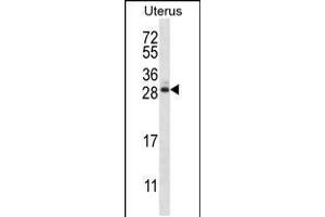 Western blot analysis in human normal Uterus tissue lysates (35ug/lane). (ARL8A Antikörper  (AA 82-110))