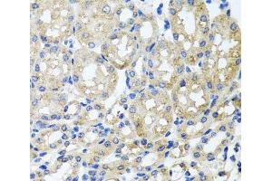 Immunohistochemistry of paraffin-embedded Mouse kidney using ST8SIA2 Polyclonal Antibody at dilution of 1:100 (40x lens). (ST8SIA2 Antikörper)