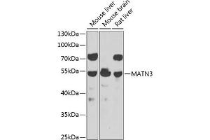 Western blot analysis of extracts of various cell lines, using M antibody  at 1:1000 dilution. (Matrilin 3 Antikörper  (AA 277-486))
