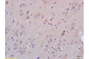 Formalin-fixed and paraffin embedded rat brain labeled with Rabbit Anti ZDHHC21 Polyclonal Antibody, Unconjugated (ABIN705566) at 1:200 followed by conjugation to the secondary antibody and DAB staining (ZDHHC21 Antikörper  (AA 131-240))