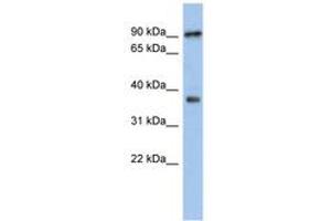 Image no. 1 for anti-Radial Spoke Head 10 Homolog B (RSPH10B) (AA 287-336) antibody (ABIN6743957) (RSPH10B Antikörper  (AA 287-336))