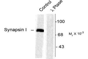 Image no. 2 for anti-Synapsin I (SYN1) (pSer603) antibody (ABIN227585) (SYN1 Antikörper  (pSer603))