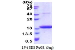 SDS-PAGE (SDS) image for STEAP Family Member 4 (STEAP4) (AA 1-152) protein (His tag) (ABIN5853589)