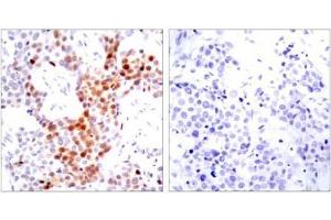 Image no. 1 for anti-Activating Transcription Factor 2 (ATF2) (pThr51), (pThr69) antibody (ABIN196665) (ATF2 Antikörper  (pThr51, pThr69))