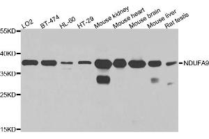 Western blot analysis of extracts of various cell lines, using NDUFA9 antibody (ABIN5971643) at 1/1000 dilution. (NDUFA9 Antikörper)