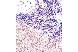 (ABIN6242141 and ABIN6578005) staining (Mouse) Suz12 in mouse spleen sections by Immunohistochemistry (IHC-P - paraformaldehyde-fixed, paraffin-embedded sections). (SUZ12 Antikörper  (AA 381-395))
