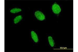 Immunofluorescence of monoclonal antibody to FLI1 on HeLa cell. (FLI1 Antikörper  (AA 1-452))