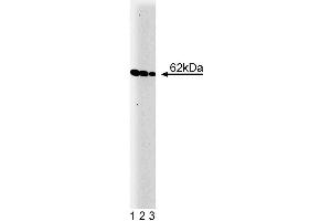 Western blot analysis of Yes on a A431 cell lysate (Human epithelial carcinoma, ATCC CRL-1555).