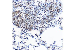 Immunohistochemistry of paraffin-embedded rat lung using Casein Kinase 2 beta (Casein Kinase 2 beta (CSNK2B)) Rabbit pAb  at dilution of 1:100 (40x lens). (CSNK2B Antikörper  (AA 1-215))