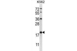 Western Blotting (WB) image for anti-Glutathione S-Transferase mu 5 (GSTM5) antibody (ABIN2996912) (GSTM5 Antikörper)
