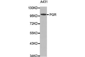 Western blot analysis of extracts of A431 cell lines, using PGR antibody. (Progesterone Receptor Antikörper  (C-Term))