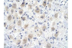 Rabbit Anti-YEATS4 antibody        Paraffin Embedded Tissue:  Human Brain cell   Cellular Data:  Epithelial cells of renal tubule  Antibody Concentration:   4. (GAS41 Antikörper  (Middle Region))