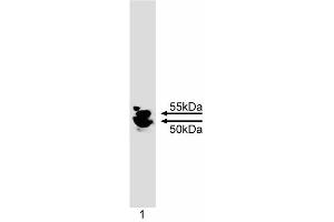 Western blot analysis of IKKgamma. (IKBKG Antikörper)