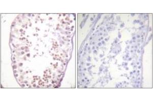 Immunohistochemistry analysis of paraffin-embedded human testis, using HDAC6 (Phospho-Ser22) Antibody.