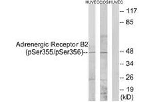 Western blot analysis of extracts from HuvEc cells treated with serum 20% 15' and COS7 cells treated with serum 20% 15', using Adrenergic Receptor B2 (Phospho-Ser355+Ser356) Antibody. (beta 2 Adrenergic Receptor Antikörper  (pSer355))