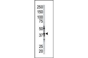 Image no. 1 for anti-Palmitoyl-Protein Thioesterase 1 (PPT1) (N-Term) antibody (ABIN357783) (PPT1 Antikörper  (N-Term))