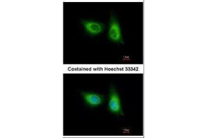 ICC/IF Image Immunofluorescence analysis of methanol-fixed A549, using SOS2, antibody at 1:500 dilution. (SOS2 Antikörper  (Center))