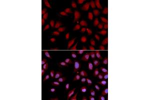 Immunofluorescence analysis of U2OS cell using DLGAP5 antibody. (DLGAP5 Antikörper)