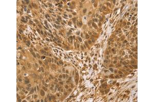 Immunohistochemistry (IHC) image for anti-Vacuole Membrane Protein 1 (VMP1) antibody (ABIN2427419) (VMP1 Antikörper)