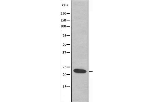 MRPL21 Antikörper  (Internal Region)