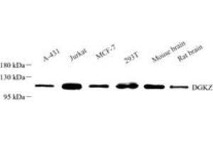 Western blot analysis of Dgkz (ABIN7073722),at dilution of 1: 1500 (DGKZ Antikörper)