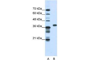 WB Suggested Anti-PCBP1 Antibody Titration:  1. (PCBP1 Antikörper  (Middle Region))